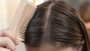 Cum previi căderea părului