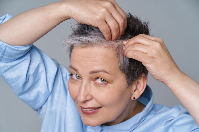 Ce este alopecia? Care sunt primele semne pe care le dă boala