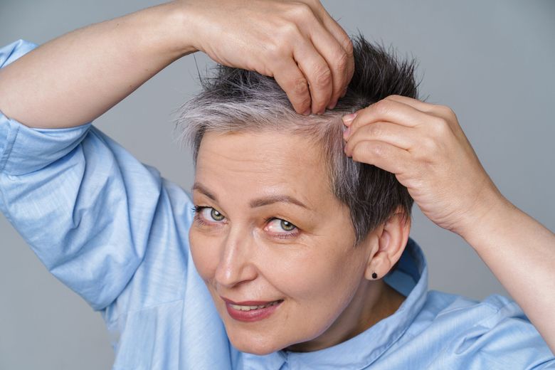 Ce este alopecia? Care sunt primele semne pe care le dă boala Ce este alopecia? Care sunt primele semne pe care le dă boala