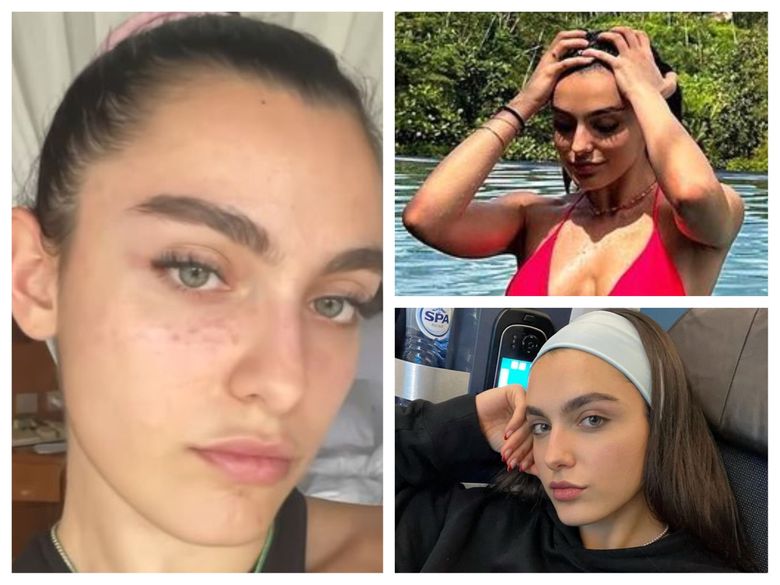 “Încerc să rezolv...” Alexia Eram se confruntă cu probleme de sănătate în vacanța exotică