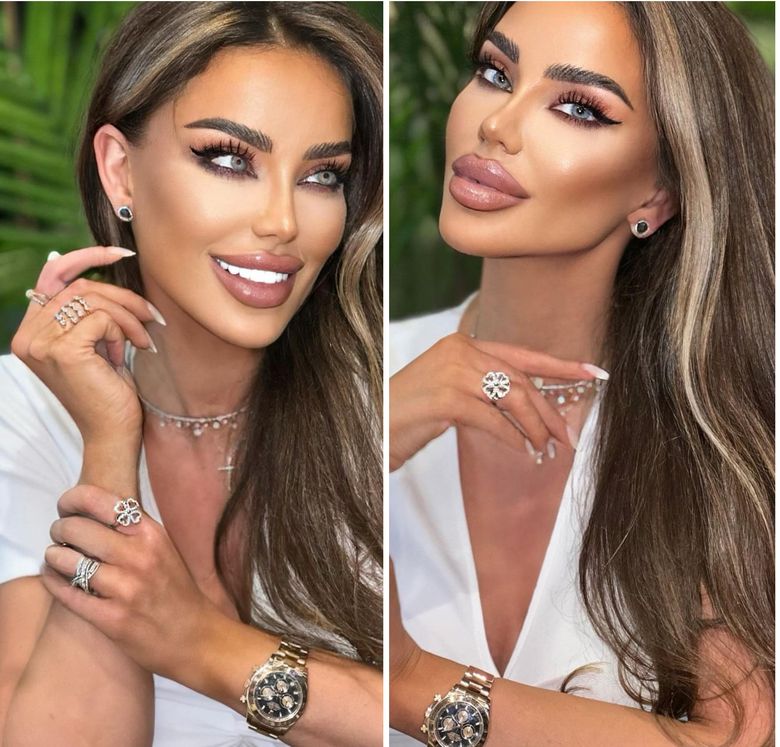 „Trebuie să stau nemachiată câteva zile.” Bianca Drăgușanu, pe mâinile medicilor, după ce a făcut alergie la un produs cosmetic