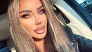  Bianca Drăgușanu suferă de diabet și este nevoită să își schimbe dantura