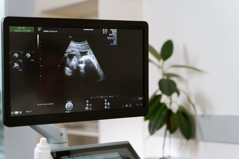 Cele mai importante momente din primul trimestru de sarcină Cele mai importante momente din primul trimestru de sarcină
