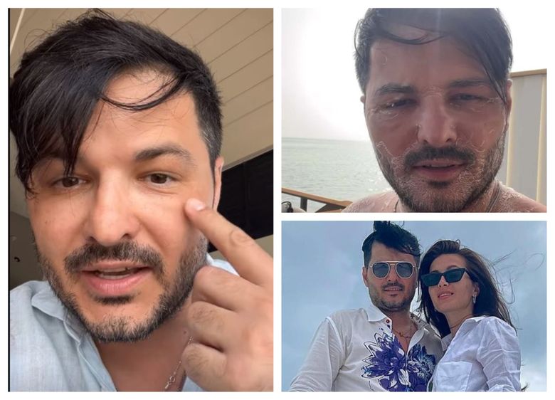 „Acum s-a uscat pe față.” Liviu Vârciu, despre starea lui de sănătate