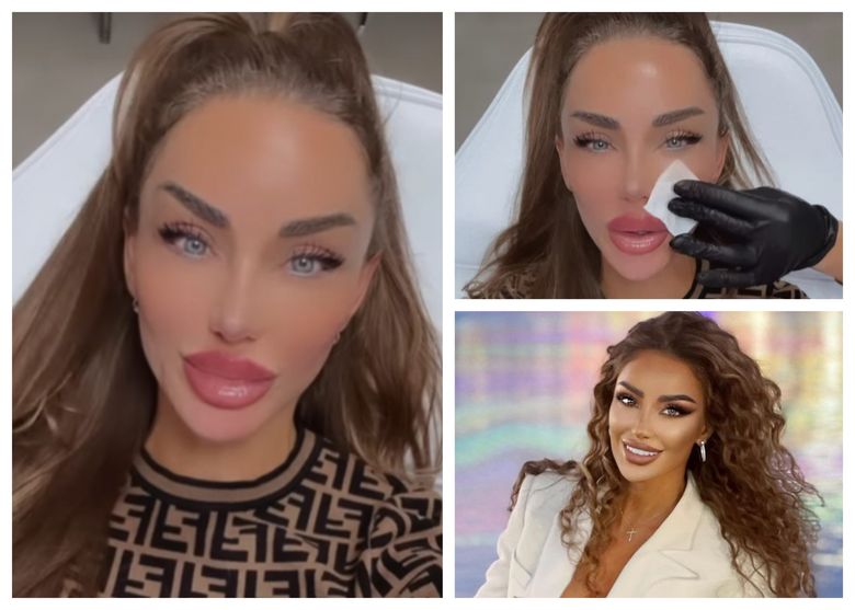 ”Mă iubesc mult de tot.” Bianca Drăgușanu, din nou pe masa medicului estetician! Ce schimbare și-a făcut vedeta