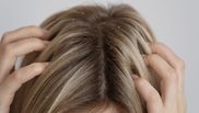 Sfaturi de la experți: cum să previi și să tratezi mătreața