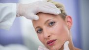 Ce presupune procedura de lifting facial