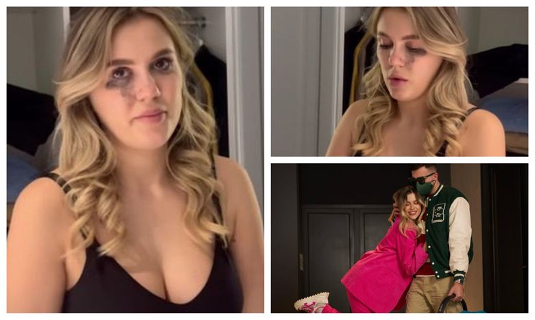 „Trebuie să îmi revin repede.” Emily Burghelea a izbucnit în lacrimi. Cu ce se confruntă influencerița