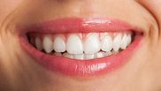 Mit sau adevăr despre albirea dinților!