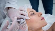 lifting facial sfaturi