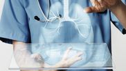 Tratament pentru cancerul pulmonar