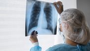 Cum se manifestă cancerul pulmonar