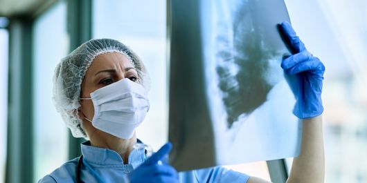 Cancerul pulmonar: cauze, simptome și tratamente eficiente. Cum să preveniți această boală