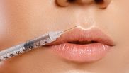 Reguli după injectarea cu acid hialuronic în buze