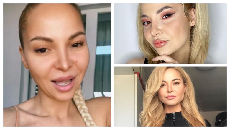 “Voi face mai multe intervenţii, sunt în plan!” Alessia își dorește să facă anumite intervenții estetice