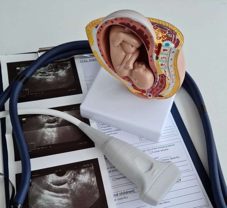 Pozițiile greșite ale copilului în mediul intrauterin. Implicații, riscuri și opțiuni pentru gestionarea pozițiilor greșite în mediul intrauterin!