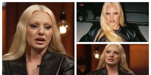 „Aveam 10 kilograme în plus atunci când m-am întors din America.” Alexandra Stan suferă de o boală autoimună. Ce a declarat vedeta despre acest subiect?