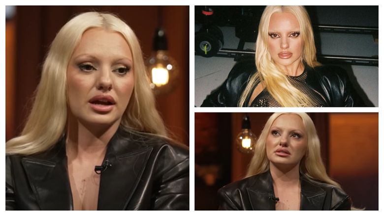 „Aveam 10 kilograme în plus atunci când m-am întors din America.” Alexandra Stan suferă de o boală autoimună. Ce a declarat vedeta despre acest subiect? „Aveam 10 kilograme în plus atunci când m-am întors din America.” Alexandra Stan suferă de o boală autoimună. Ce a declarat vedeta despre acest subiect?