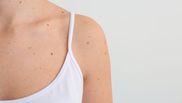 importanta protectiei solare