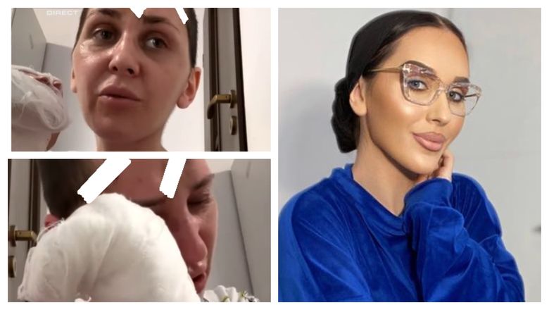 „Nu îmi este ușor să mă văd fără păr în cap, cu mâinile bandajate, cu cicatrici pe față.” Dana Roba trece prin clipe grele după ce a fost mutilată de soț „Nu îmi este ușor să mă văd fără păr în cap, cu mâinile bandajate, cu cicatrici pe față.” Dana Roba trece prin clipe grele după ce a fost mutilată de soț