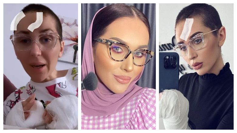 „ Nu o să mai pot munci niciodată. Pentru siguranța copiilor mei am vrut să divorțez, să fie totul OK.” Dana Roba, cuprinsă de suferința la gândul că nu o să-și mai poată folosi mâinile niciodată