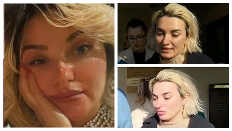 „ Încerc să nu cad în butoiul cu tristețe.” Ana Morodan, apariție îngrijorătoare pe rețelele de socializare! Ce se întâmplă cu vedeta, la trei luni de când a produs un accident rutier „ Încerc să nu cad în butoiul cu tristețe.” Ana Morodan, apariție îngrijorătoare pe rețelele de socializare! Ce se întâmplă cu vedeta, la trei luni de când a produs un accident rutier