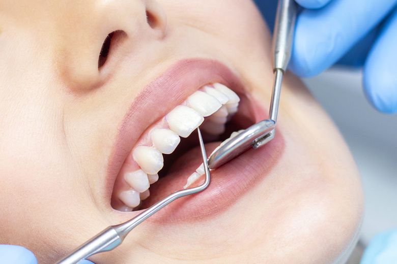 durata de viata a unui implant dentar