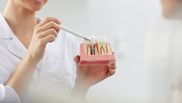 implanturi dentare sfaturi