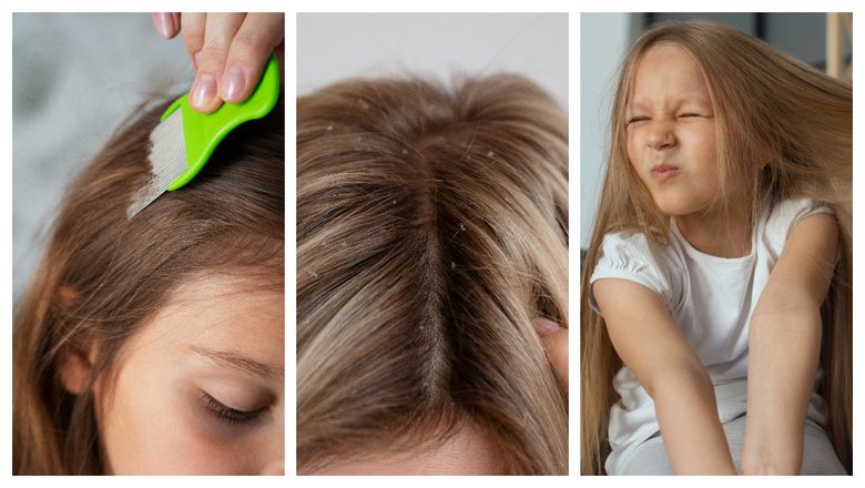 „Vecina mea refuză să scape de păduchii fiicei sale pentru că este vegană!”