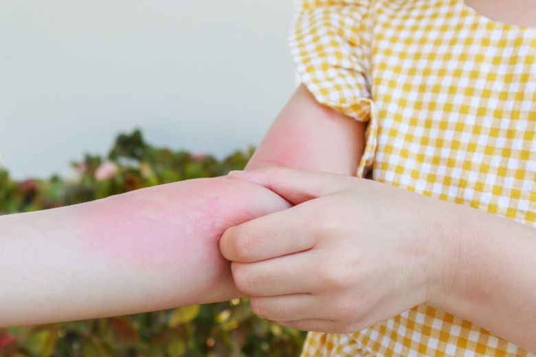 Descifrând enigma bolii Lyme. Simptome, diagnostic și tratament 
