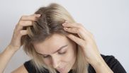 Scapă de mătreață cu ajutorul unei măști pe bază de ulei de măsline și zahăr brun! Trucul prin care femeile pot avea un scalp sănătos