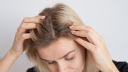 Scapă de mătreață cu ajutorul unei măști pe bază de ulei de măsline și zahăr brun! Trucul prin care femeile pot avea un scalp sănătos