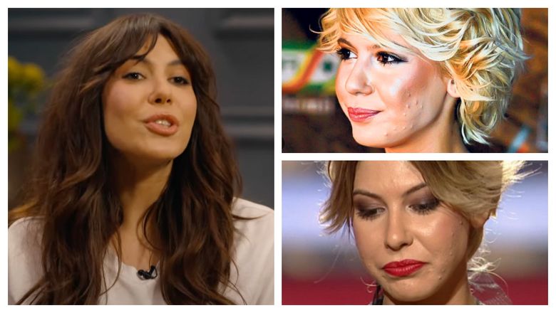 Sore a explicat cum se simțea în perioada când se confrunta cu acneea: „Mă simțeam criticată, analizată constant.” Sore a explicat cum se simțea în perioada când se confrunta cu acneea: „Mă simțeam criticată, analizată constant.”