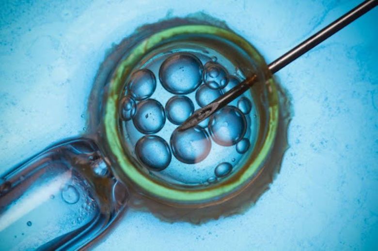 Fertilizarea in vitro vs. inseminarea intrauterină Fertilizarea in vitro vs. inseminarea intrauterină