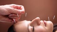 ce trateaza acupunctura