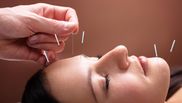 ce trateaza acupunctura
