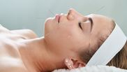ce este acupunctura