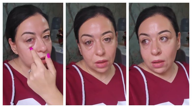 Oana Roman, apariție îngrijorătoare pe rețelele de socializare: „Am efectiv un ochi distrus. Va trebui să mă duc la spital.” Oana Roman, apariție îngrijorătoare pe rețelele de socializare: „Am efectiv un ochi distrus. Va trebui să mă duc la spital.”