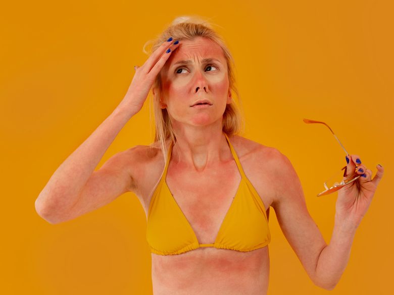 Remedii naturiste pentru arsuri solare 3 remedii naturiste pentru arsuri solare. Ce metode simple și rapide poți folosi pentru a-ți îngriji pielea