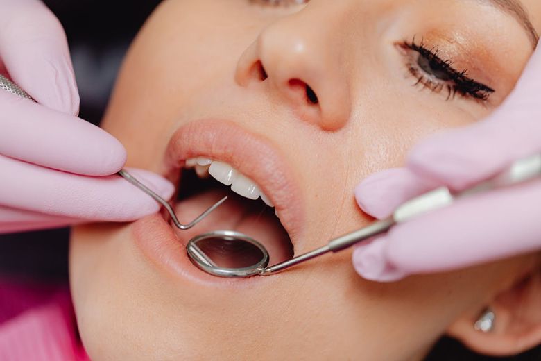 Ce este o coroană dentară și când este necesară aceasta Ce este o coroană dentară și când este necesară aceasta