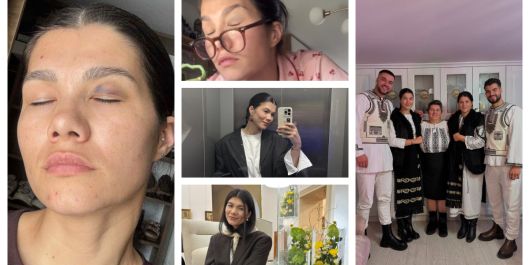 Ileana Sterp s-a trezit cu un ochi vânăt. La ce explicație se gândește tânăra. „Ce legătură să aibă, de ce să apară abia acum?”
