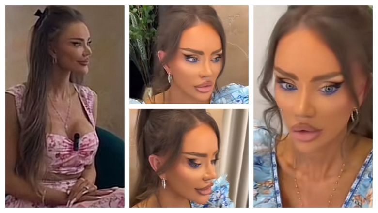 Ce regret are Bianca Drăgușanu cu privire la intervenții estetice și ce anume nu recomandă: „Nu faceți vreodată prostia asta, pe care eu o regret.”