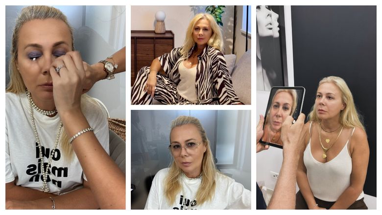 La ce intervenție estetică a apelat Dana Săvuică. Vedeta a postat primele imagini și a spus motivul pentru care a pășit pragul cabinetului estetician: „După operație am plecat imediat acasă.”