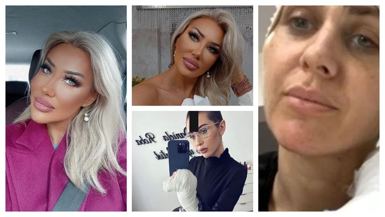 Încă o make-up artistă cunoscută a trecut prin momente de coșmar. A fost desfigurată de fostul soț și continuă să o amenințe: „Urla și spunea că mă face țăndări ca pe Dana Roba.”