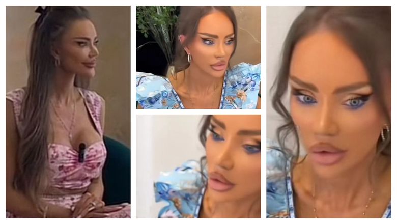 Bianca Drăgușanu, la o lună după intervenția pe care a avut-o la buze. Ce spune vedeta despre operațiile estetice și ce le răspunde celor care o critică: “O să mă operez până o să arăt ca filtrele.”