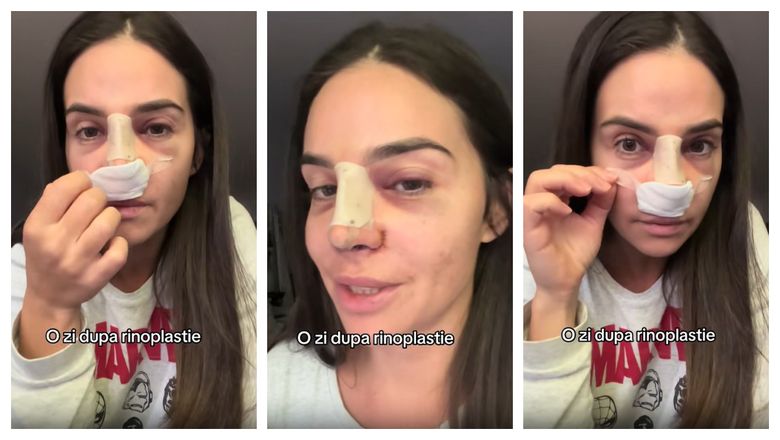 FOTO Artista Mellina, pe masa de operație! La ce procedură a recurs frumoasa vedetă, dar și cum se simte acum? 