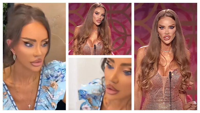 Bianca Drăgușanu le răspunde urmăritorilor care i-au comentat apariția la un post de televiziune. Ce le transmite și ce intervenții mai dorește să își facă: „Eu sunt foarte confortabilă cu mine.”