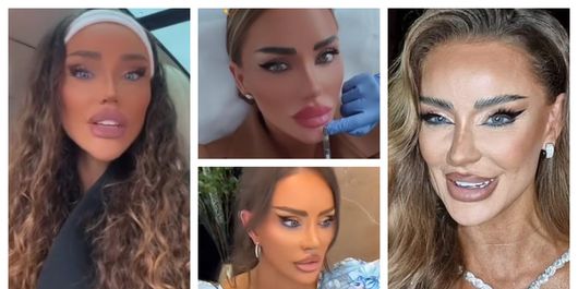 Bianca Drăgușanu a dezvăluit motivul pentru care alege să își topească buzele, din când în când! Vedeta TV știe și când va renunța la acest obicei