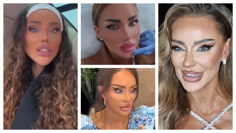 Bianca Drăgușanu a dezvăluit motivul pentru care alege să își topească buzele, din când în când! Vedeta TV știe și când va renunța la acest obicei