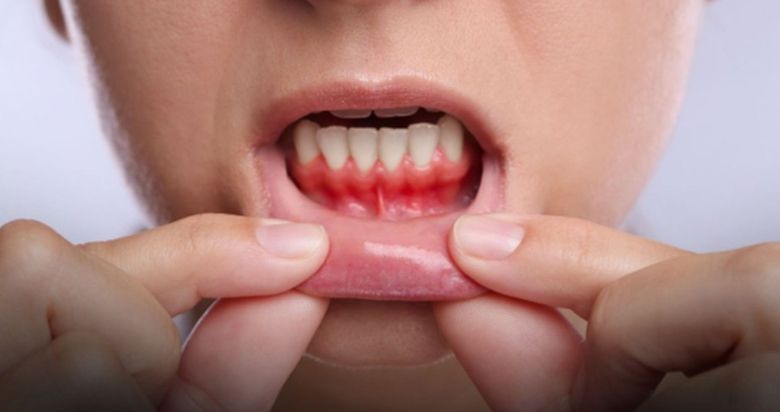 (P) Cum îți poate schimba viața sănătatea gingiilor? 7 adevăruri pe care nu ți le spune nimeni